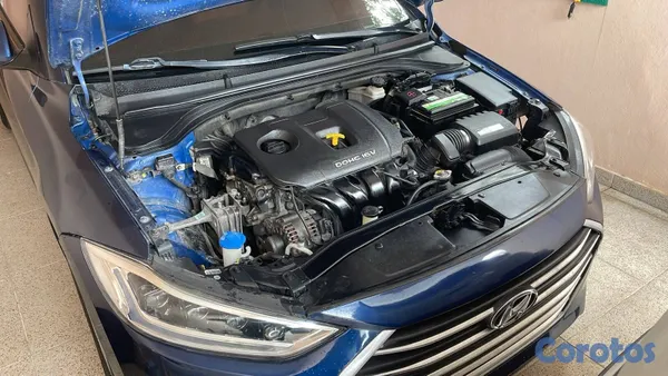 2017 Hyundai Elantra — foto 2 / 5