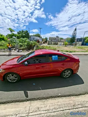 2018 Hyundai Elantra — foto 4 / 6
