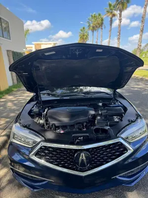 2018 Acura Tl — foto 3 / 5